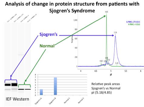 tear test for sjogrens|blood tests for sjogren's.